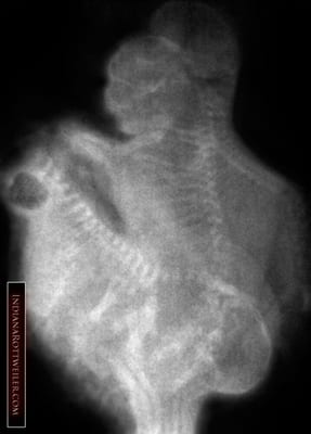 rottweiler pregnancy care in the last week of pregnancy dr grabow does an xray to get a headcount of how many rottweiler pregnancy care in the last week of pregnancy dr grabow does an xray to get a headcount of how many