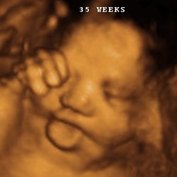 26 week 4d ultrasound