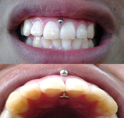 gum piercing yelp gum piercing yelp